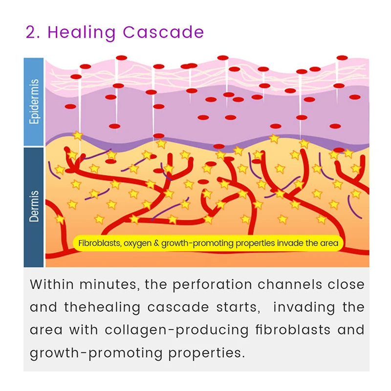 10-in-1 Derma Roller Kit 0.25mm – Microneedling Skin Care Tool