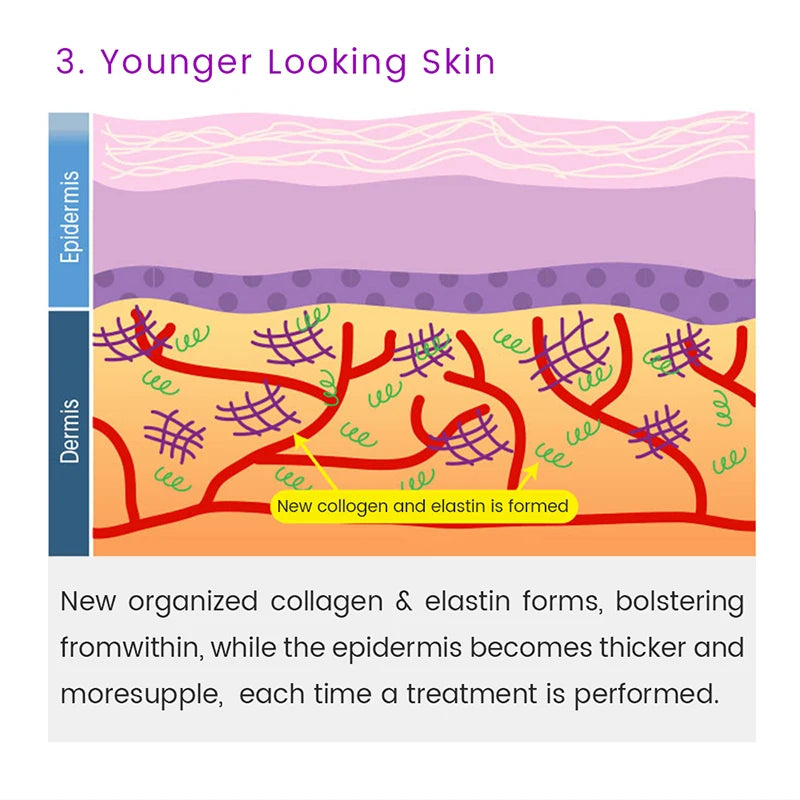 10-in-1 Derma Roller Kit 0.25mm – Microneedling Skin Care Tool