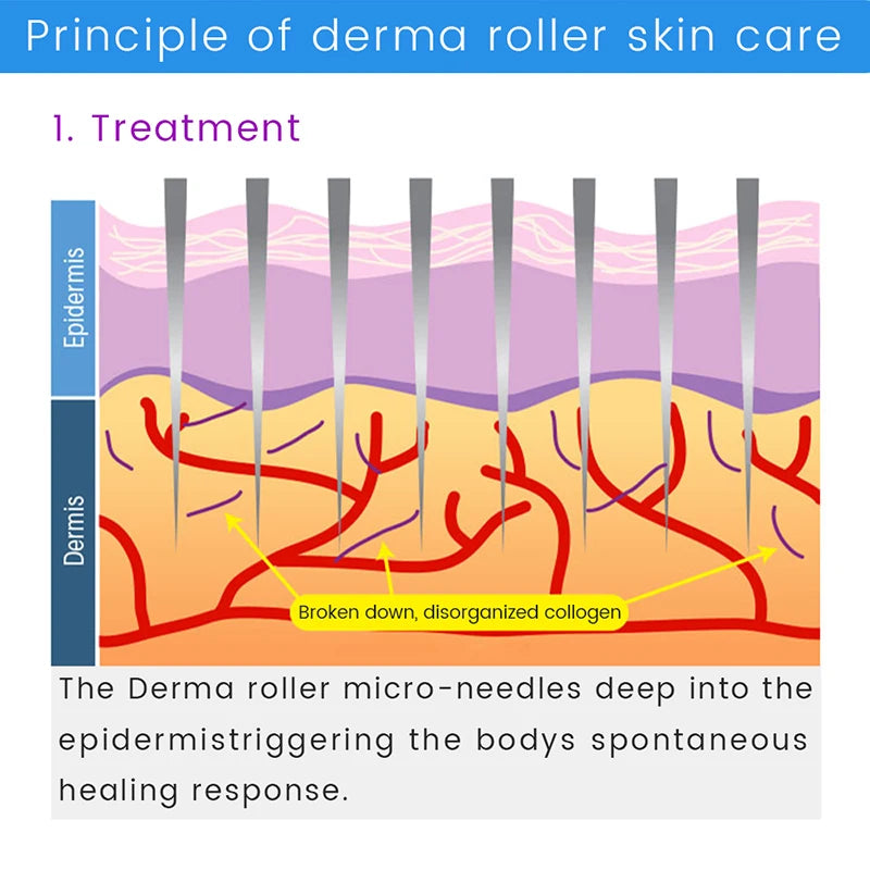 10-in-1 Derma Roller Kit 0.25mm – Microneedling Skin Care Tool